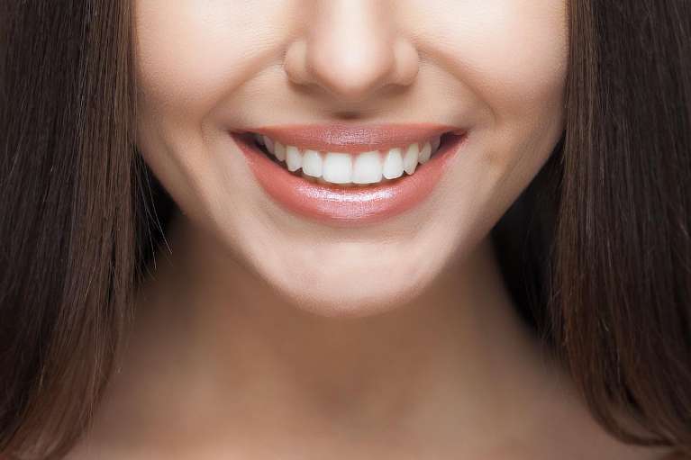 A smiling woman with straight teeth | Invisalign Arlington